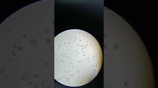 Pollen grain of Jasmine flower  Class 12th Board practical syllabus  neet biology education [upl. by Eladnar]