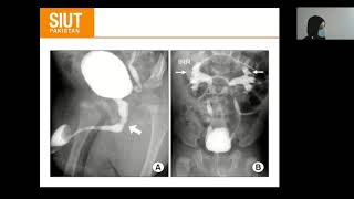 Urological investigation 03 Cystogram Urethrogram Antrograde Transrectal Ultrasound [upl. by Ebony]