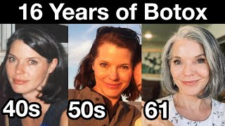 My 16 Year Botox Journey for Preventing Wrinkles  Antiaging Strategies for 40s 50s and 60s [upl. by Ader]