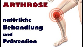 ARTHROSE  natürliche Behandlung und Prävention  Faszientraining Gold MSM oder doch die Prothese [upl. by Hak]