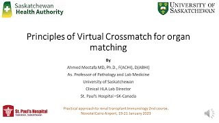 Principles of Virtual Crossmatch for solid Organ Matching [upl. by Pfeffer784]