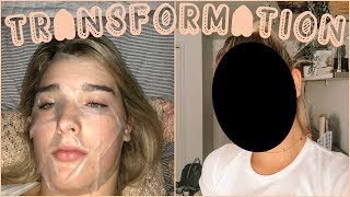 my transformation from a 2 to maybe a 75 in 24 hours [upl. by Trilly]