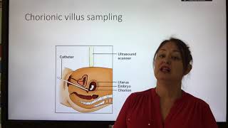 GCSE 1310 Genetic screening [upl. by Lamrert]