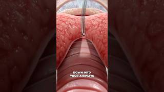 Bronchoscopy 3D Animation [upl. by Pascasia]