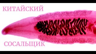 Клонорх Китайская Двуустка Clonorchis sinensis Клонорхоз Строение Клиника Диагностика Профилактика [upl. by Tamer]