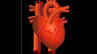 Attaque cardiaque infarctus du myocarde [upl. by Omura202]