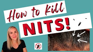 How to Kill Nits amp Lice Eggs Tutorial [upl. by Randee]