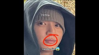 WHY TAEKOOKS LIPS WERE SWOLLEN👀💋 taehyung jungkook bts army fyp trending taekook [upl. by Elodia]