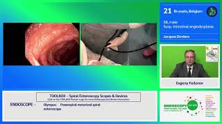 EOA 2020 Case 17 spiral enteroscopy Deviere [upl. by Yvette831]