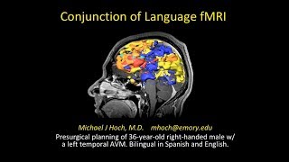 Functional MRI fMRI BOLD imaging  using conjunction display for language mapping [upl. by Edlin294]