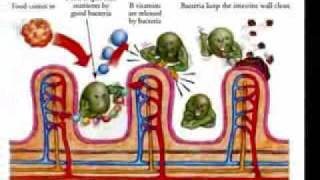 CONSTIPATION your bodys GREATEST enemy  CLEANSE NOW [upl. by Ronna]