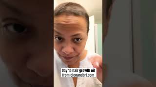 Day 15 hair growth oil application from cleoandbricom [upl. by Dempster854]