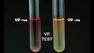 Voges Proskauer Test [upl. by Leonerd]