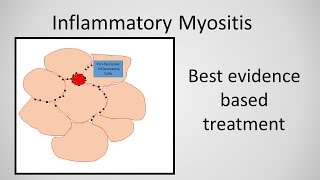 Myositis Inflammatory Myopathy Treatment [upl. by Moreville]