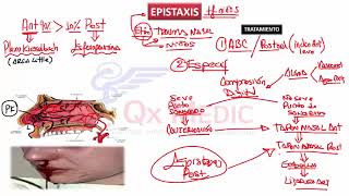 Bancos  4 RM19 3V OTORRINO PREGUNTAS 63 AL 96 de Qx Medic on Vimeo [upl. by Ayiotal]