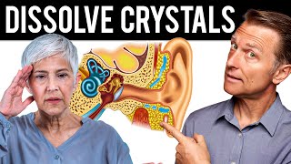 How to Dissolve Crystals in the Inner Ear and Get Rid of Vertigo [upl. by Pastelki]