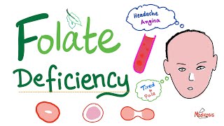 Folate deficiency  Megaloblastic Anemia  Macrocytic  Hematology Series [upl. by Sesmar]