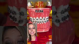 🚨 AVOID THESE BRACES COLORS EXPLAINED 🦷 TIP FOR FALL [upl. by Guillemette]