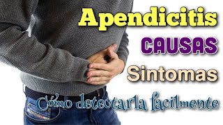 ▶︎ APENDICITIS 5 SINTOMAS 🔥 que NO FALLAN GARANTIZADO👨‍⚕️ [upl. by Dennie]