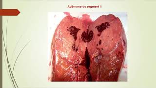 Module de Gastrologie [upl. by Matless]