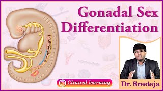 11 Gonadal Sex Differentiation [upl. by Anirbed]