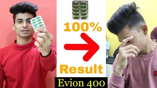 Evion 400  Vitamin E Capsules  Use For Hair Growth amp hair fall  Hair treatment  Oye Semii [upl. by Carie]