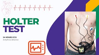 What is Holter Monitoring  24 hours ECG test  Holter test [upl. by Schurman]