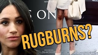 Rugburns Meghan Markle [upl. by Ydnab]