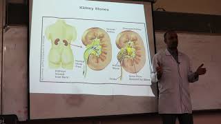 Gout and Hyperuricemia By Dr Dheyaa Jabbar [upl. by Conny366]