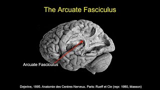 CARTA Comparative Anthropogeny Human Arcuate Fasciculus [upl. by Newcomb537]