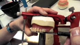 Setting up FF Class I Dentures  Lambeth College London [upl. by Gitel565]