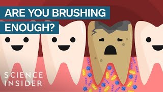 Heres What Happens If You Stopped Brushing Your Teeth [upl. by Ivatts650]