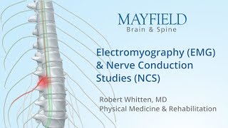 Electromyography EMG amp Nerve conduction studies NCS [upl. by Aiksa]