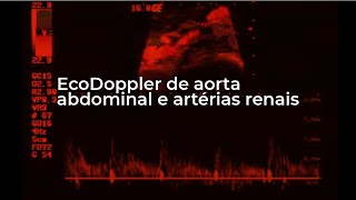 EcoDoppler de aorta abdominal e artérias renais [upl. by Hagile]