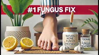 1 Toenail Fungus Treatment 10 MustTry Home Remedies [upl. by Akeryt]