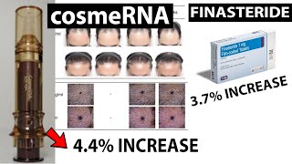 CosmeRNA NEW HAIR LOSS TREATMENT in the pipelines mRNA based Anti Androgen [upl. by Marrissa1]