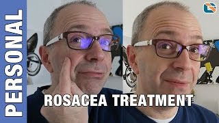 Rosacea Mirvaso Gel Cream Treatment Test  Geek Vlog 376 Rosacea [upl. by Richela776]