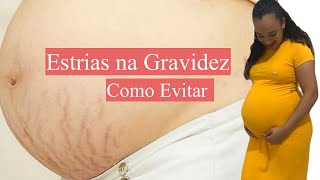 Estrias na Gravidez Como Evitar [upl. by Cloots]