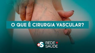 O QUE É A ANGIOLOGIA CIRURGIA VASCULA [upl. by Edlin]