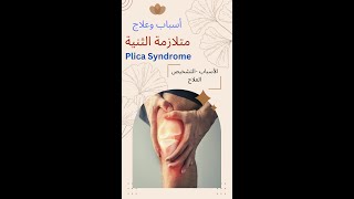 plica syndrome متلازمة الثنية [upl. by Salta962]