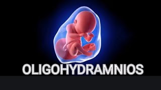 Oligohydramnios in Urdu  پانی کی کمی  Low AFI ultrasound  Pregnancy men baby water ki kami [upl. by Zina]