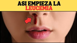 Que es la LEUCEMIA Causas Sintomas y Tratamiento [upl. by Hitt]