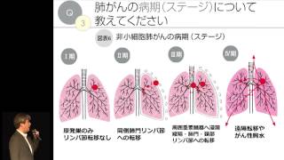 肺がんの概要 藤高一慶 [upl. by Walli]