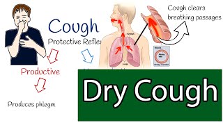 Understanding Dry Cough Causes Symptoms and Treatment Options [upl. by Perle]