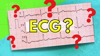 How to Read an Electrocardiogram ECGEKG [upl. by Hitt603]