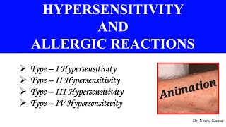 Type I II III amp IV Hypersensitivity Animation  Allergic reactions [upl. by Emiolhs]