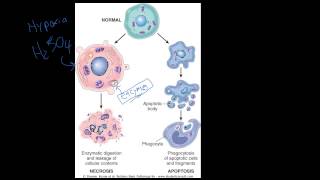 4  Introduction to Pathology  Necrosis vs Apoptosis [upl. by Nylicaj]