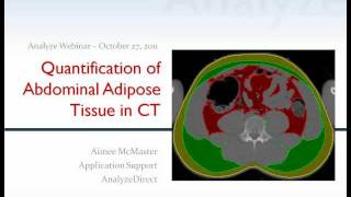 Quantification of Abdominal Adipose Tissue from CT using Analyze 100  Webinar [upl. by Jauch]