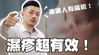 濕疹、汗皰疹好不了！？簡單幾招還你美麗好皮膚！癢癢必學！【77老大】 [upl. by Hedve]