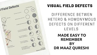 Visual Pathway amp Field Defects  lesions  On Different Levels  Made Easy  Homo amp Heteronymous [upl. by Rollo92]